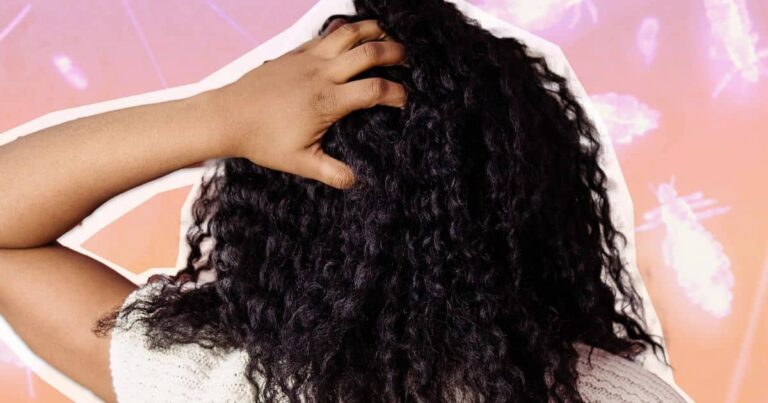 How to Get Rid of Lice in Curly Hair?