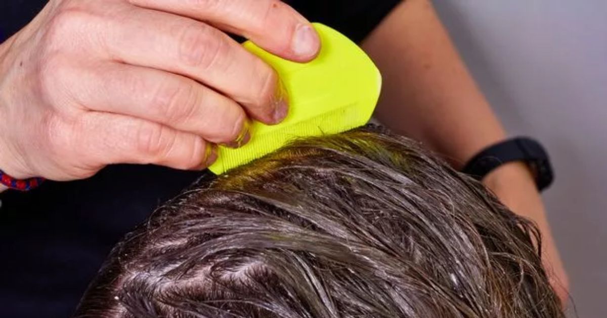 Removing Lice Eggs From Curly Hair